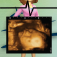  Virtual Ultrasound 