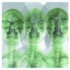 Supergrass
