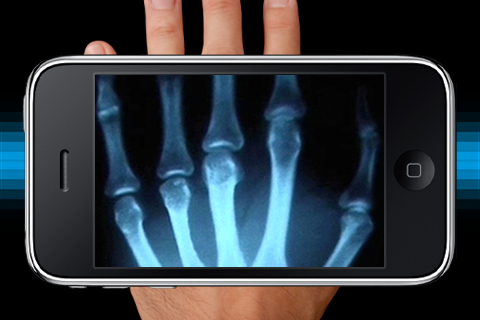 Image of X-Ray