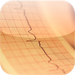 Advanced EKG