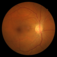 Ophthalmology
