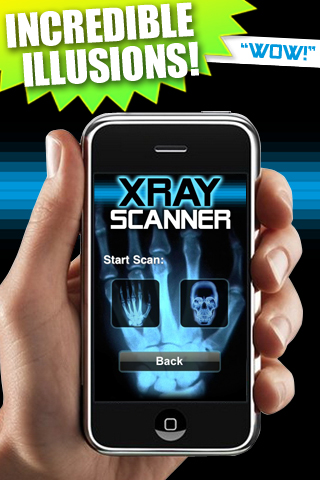 Image of X-Ray